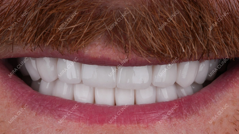 Smile Photos and X-Ray